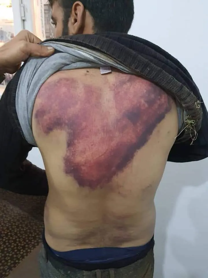 بعد تعذيبهم..الجندرما التركية ترمي ثلاثة شبان من على حائط ارتفاعه 3 أمتار