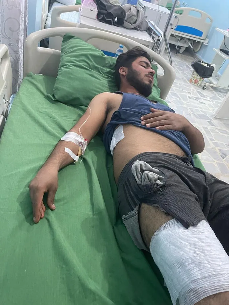 إصابة 3 مدنيين في قصف طائرة مسيرة للاحتلال التركي لسيارة في كوباني