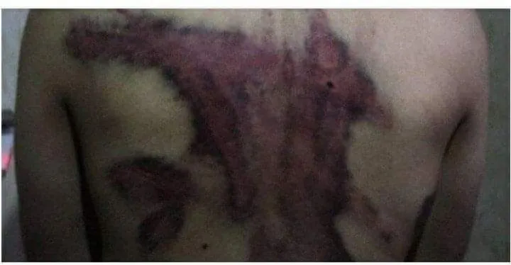 ​​​​​​​صورة مسربة من كري سبي المحتلة تظهر وحشية المرتزقة بحق المختطفين في السجون