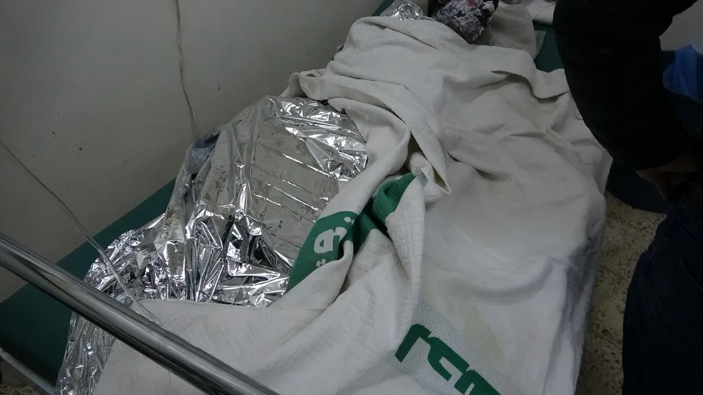 حريق في منزل بديرك نتيجة انفجار اسطوانة غاز