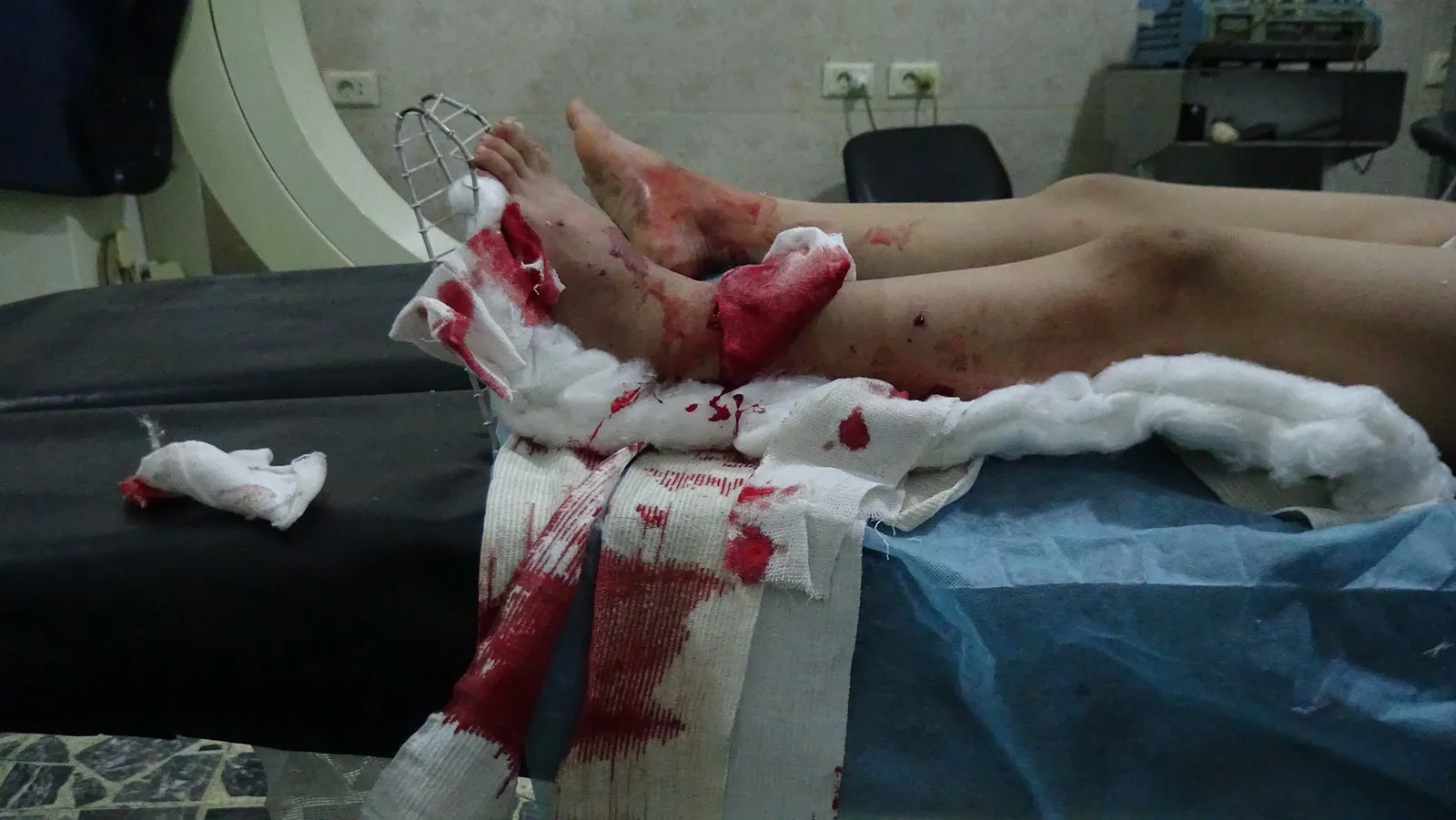 ​​​​​​​الاحتلال التركي يهدد حياة 21 ألف مواطن في ناحية تل رفعت ومقاطعة الشهباء كل يوم