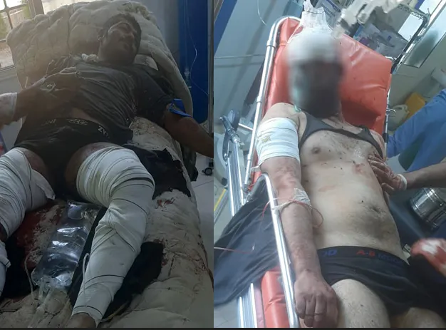 ​​​​​​​إصابة عنصرين من قوات حكومة دمشق إثر انفجار لغم بهما في ريف كري سبي الغربي
