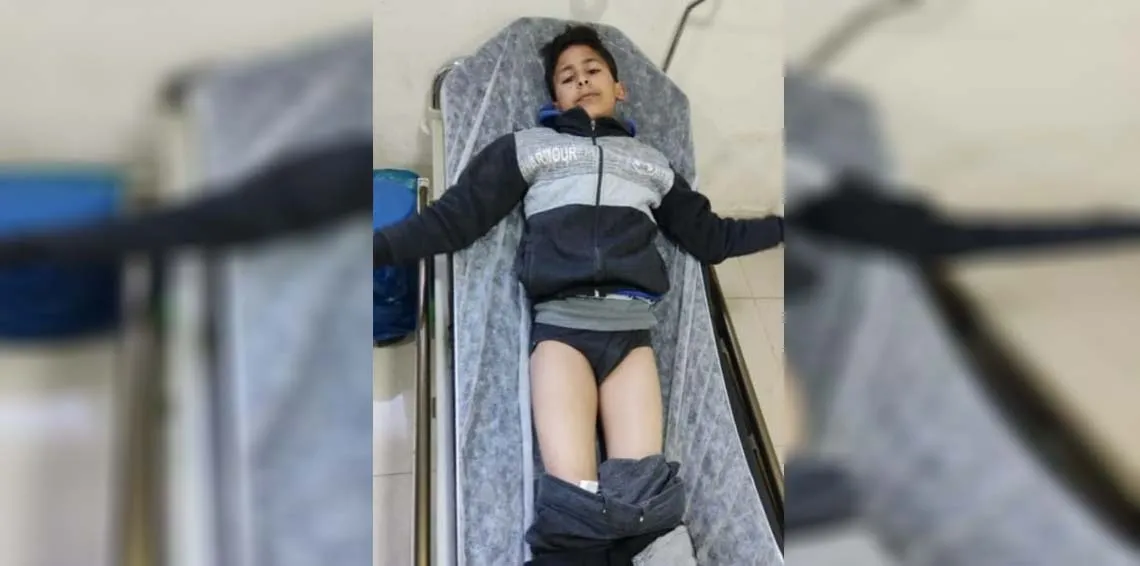 ​​​​​​​إصابة 10 أطفال جراء إطلاق مرتزقة الاحتلال التركي الرصاص صوب مدرسة في عفرين المحتلة