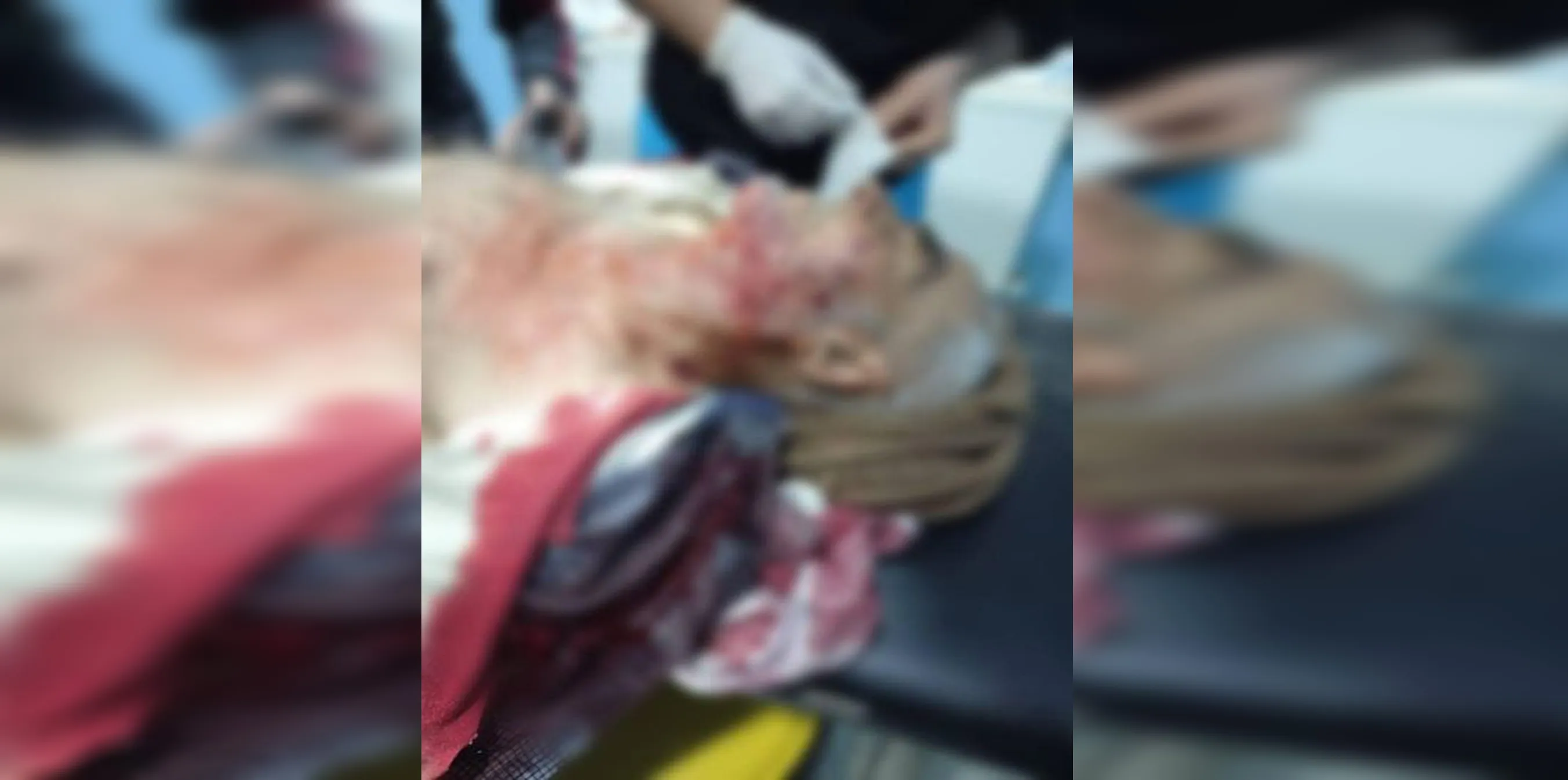 ​​​​​​​مقتل مسن متأثراً بجراحه جراء اشتباكات بين مرتزقة الاحتلال التركي في عفرين المحتلة