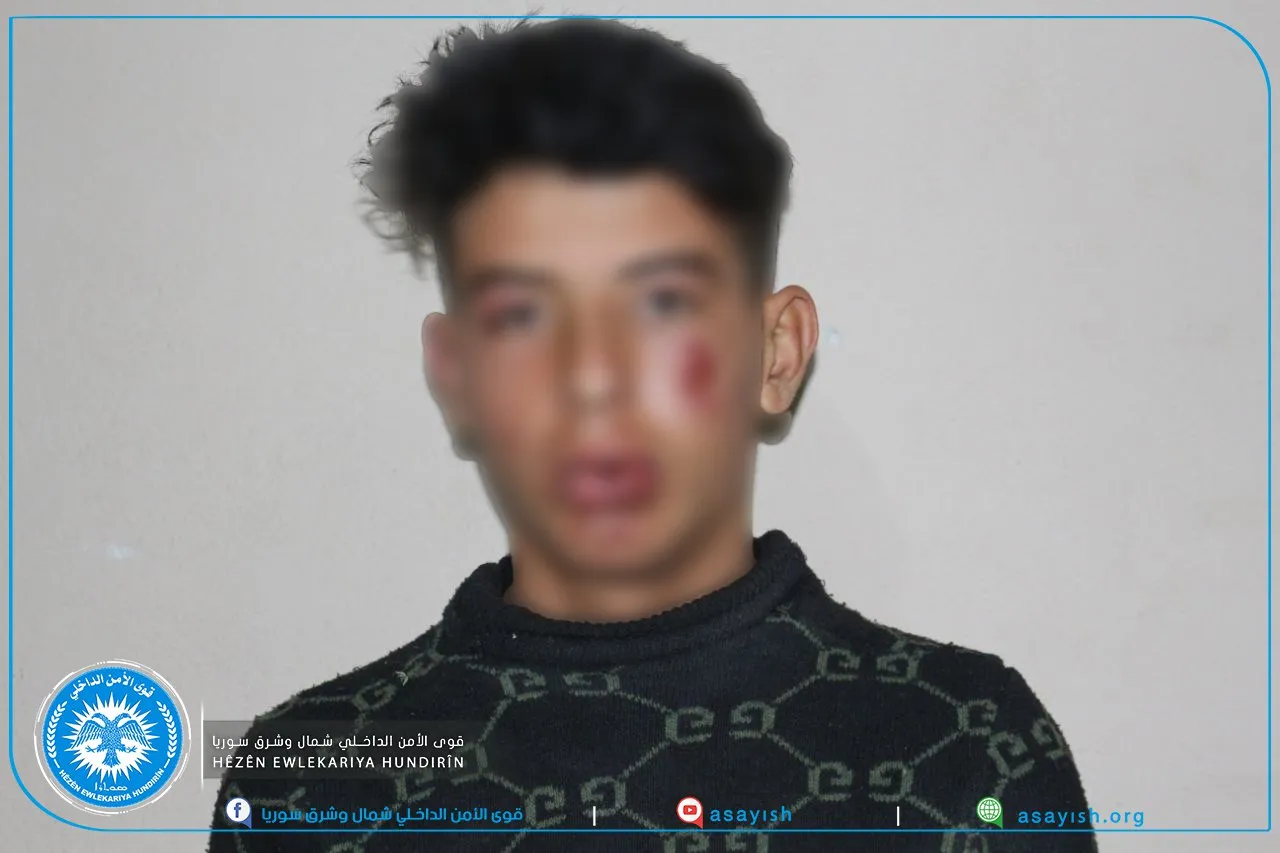 ​​​​​​​جنود الاحتلال التركي يعتدون بشكل وحشي على ثلاث شبان بريف كوباني