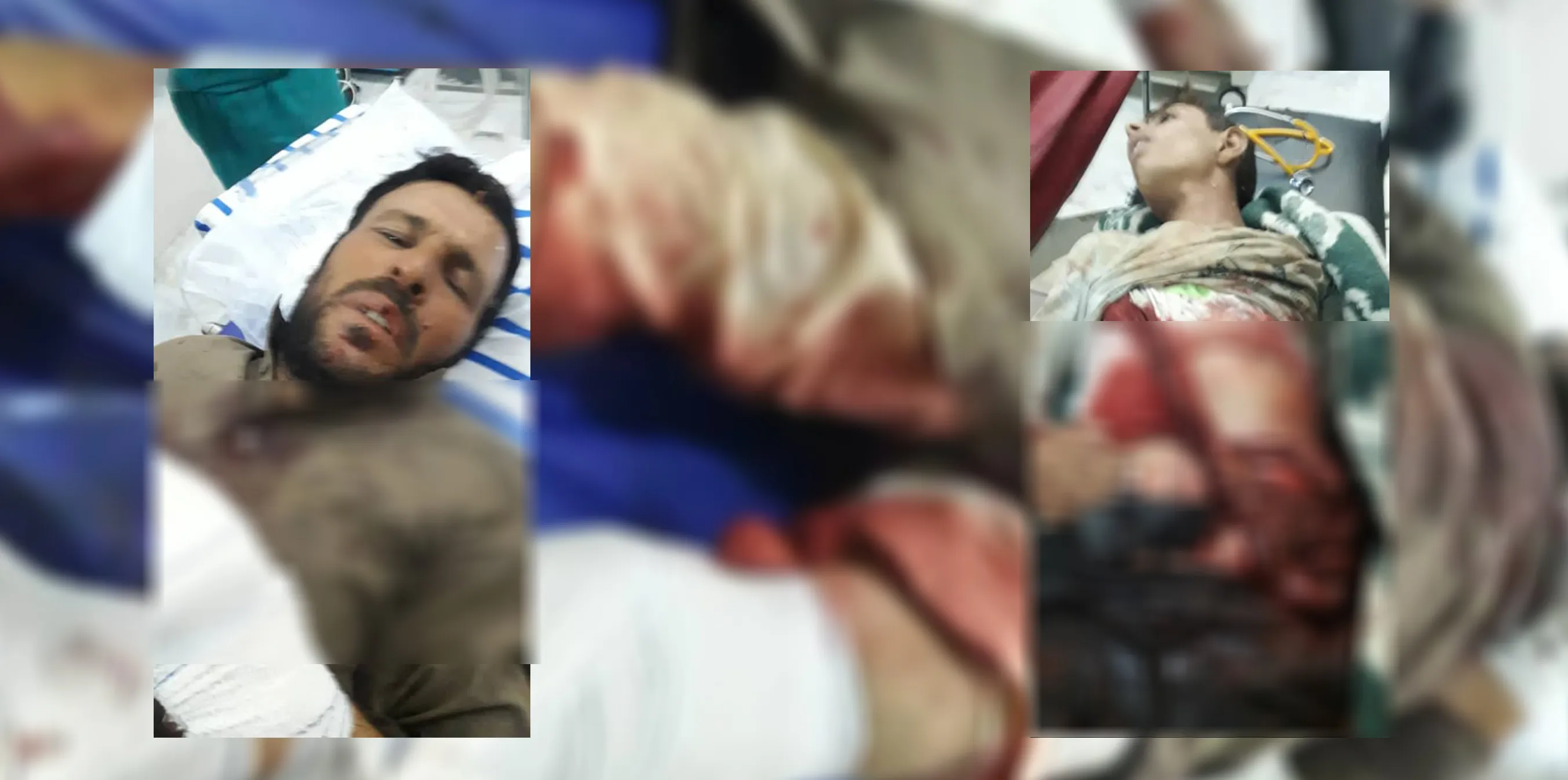 ​​​​​​​استشهاد طفل وإصابة 3 أشخاص جراء القصف التركي الوحشي على كوباني
