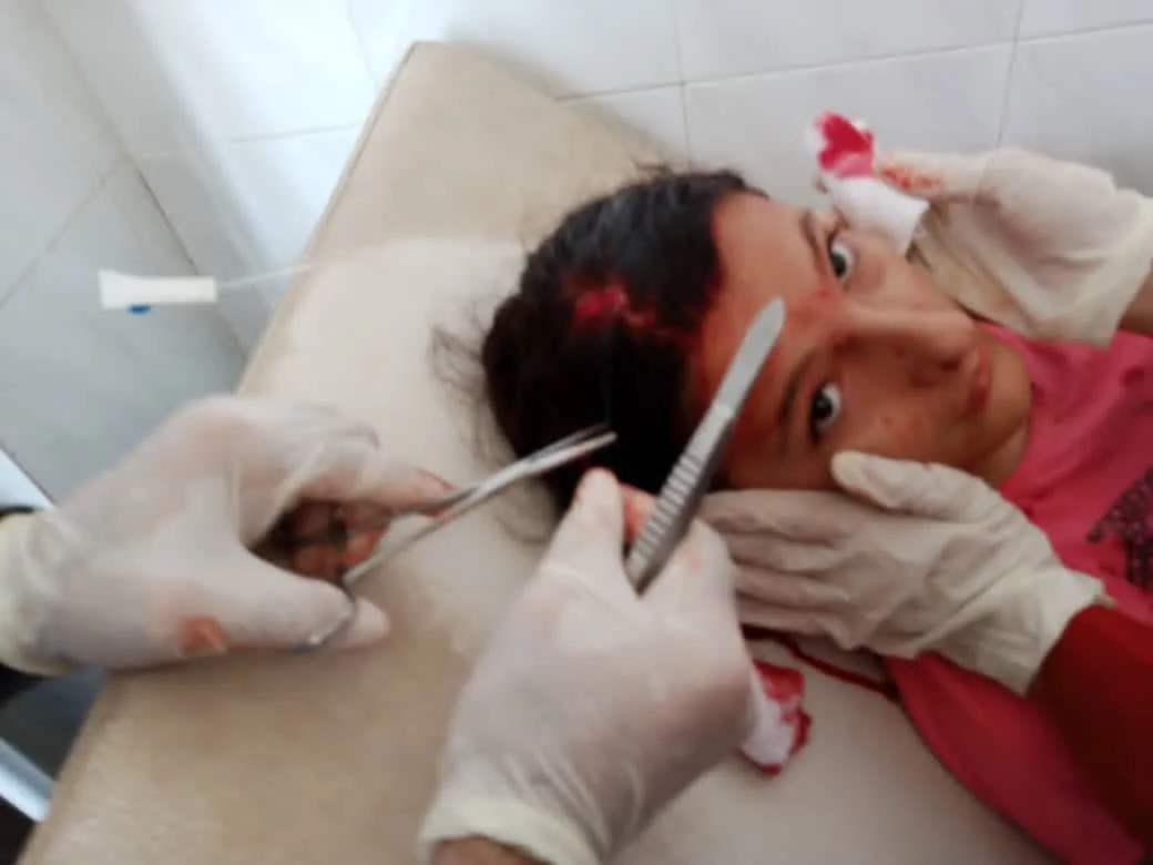 6 منهم أطفال.. إصابة 9 مواطنين جراء استهداف المسيّرة الانتحارية التركية لمركز تل رفعت - تم التحديث