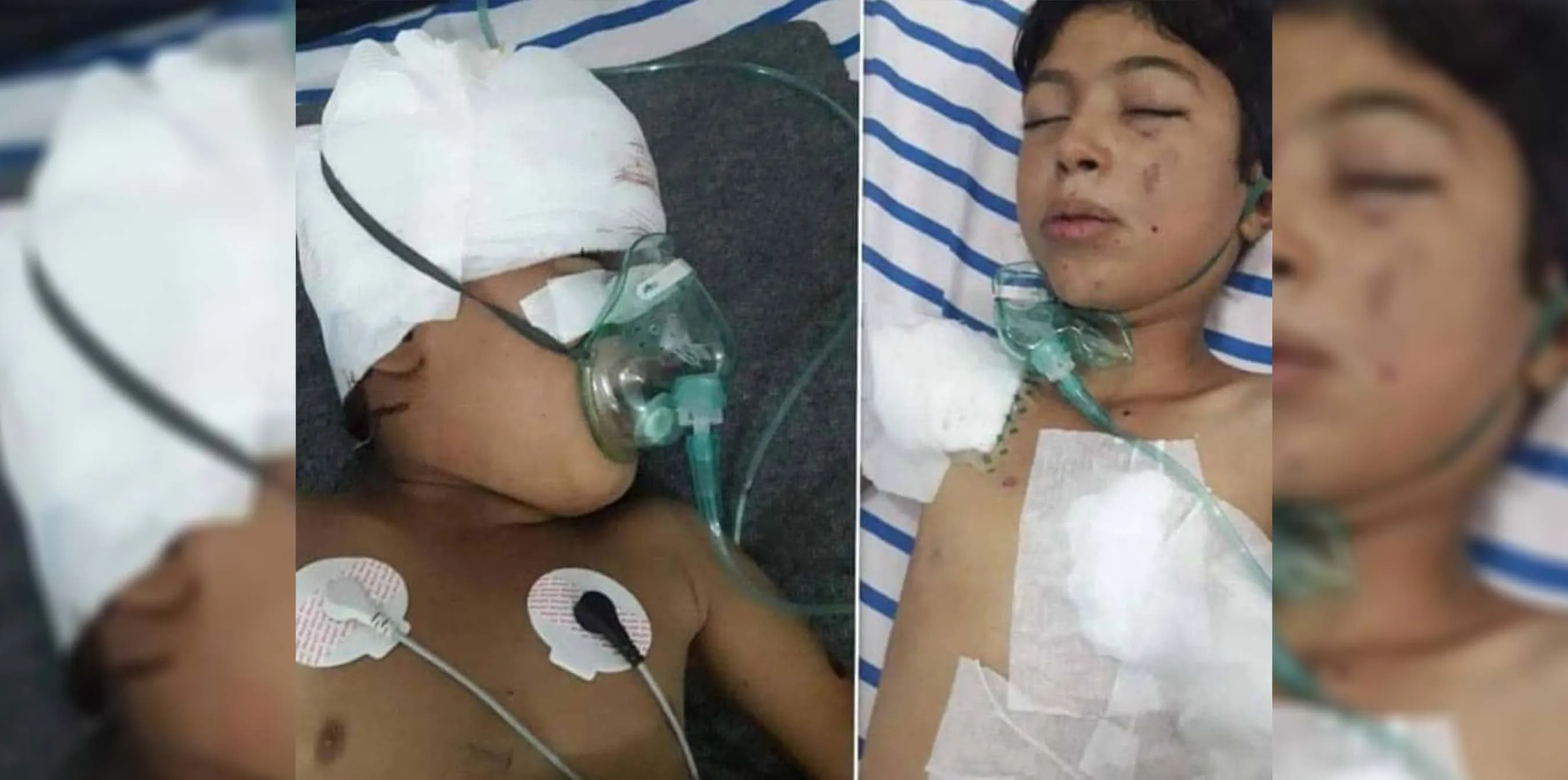 إصابة 4 أطفال جراء انفجار لغم من مخلفات داعش في ريف عين عيسى