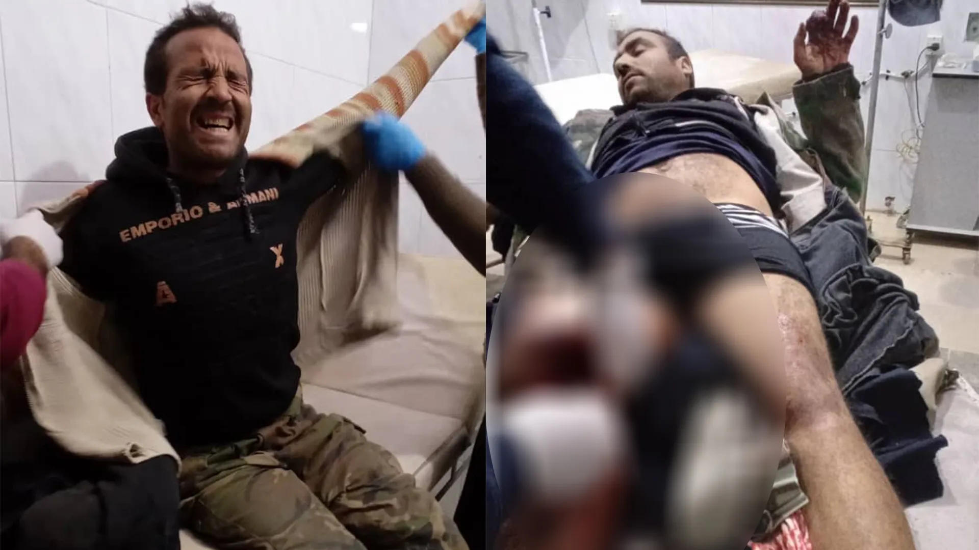 فقدان عنصرين لحياتهما وإصابة اثنين آخرين من قوات حكومة دمشق في قصف للاحتلال التركي