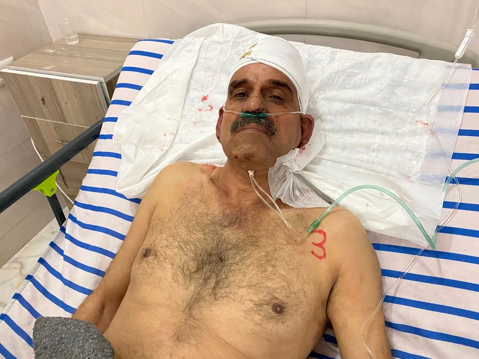 ​​​​​​​وضع أحد المصابين في استهداف مديرية المياه بقرية شيوخ فوقاني غير مستقر