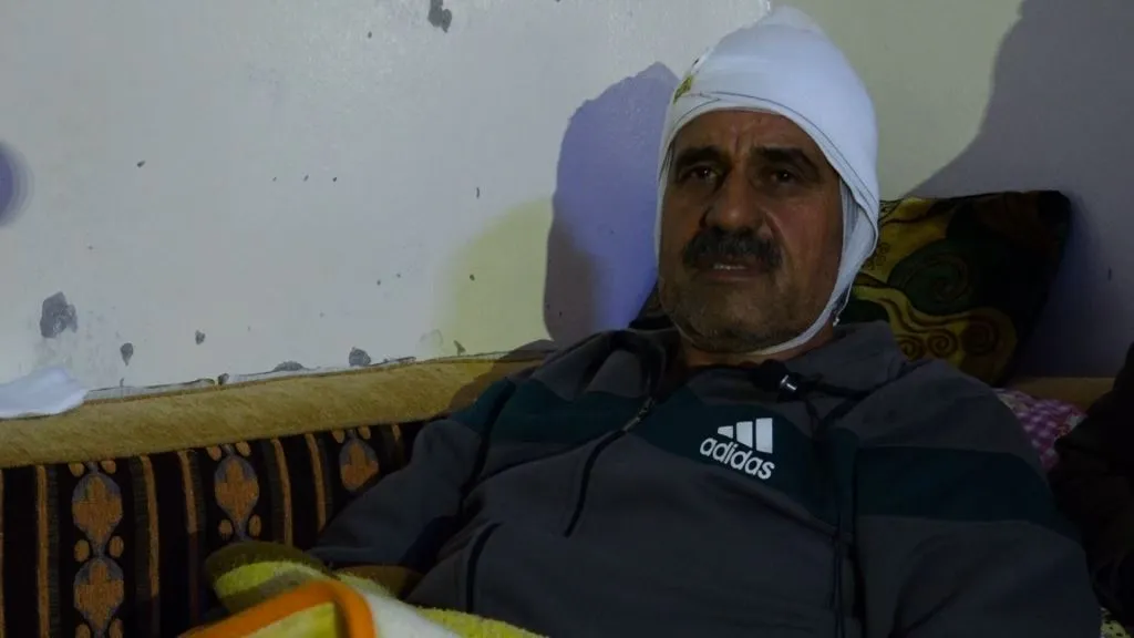 ​​​​​​​وضع أحد المصابين في استهداف مديرية المياه بقرية شيوخ فوقاني غير مستقر