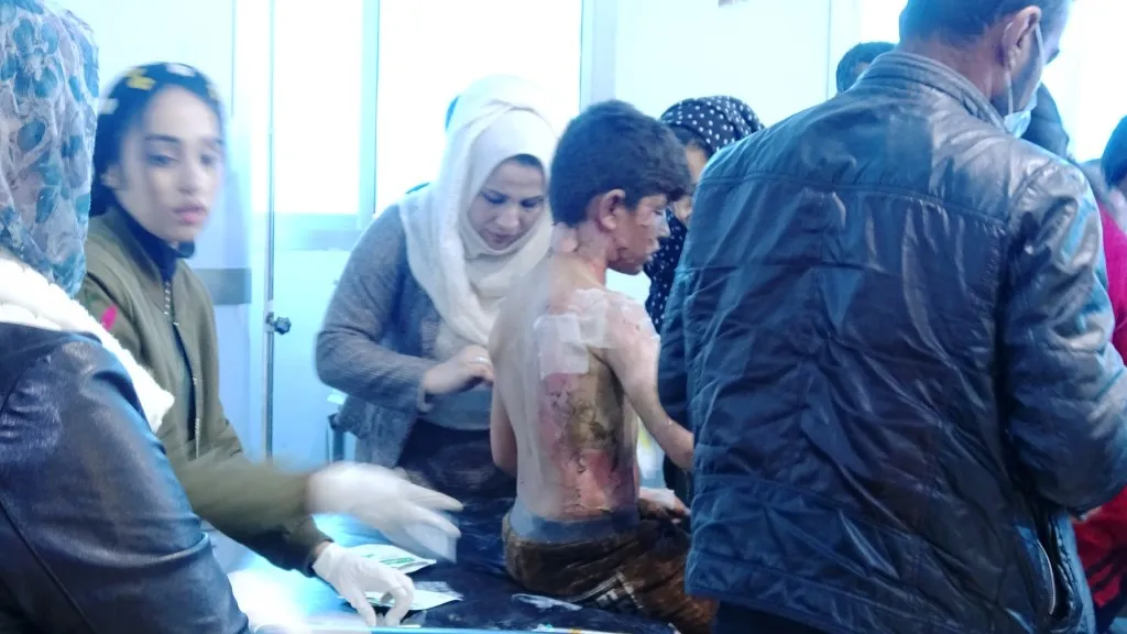 ​​​​​​​حالة المصابين جراء احتراق خيمة صفية بمخيم مهجري كري سبي يوم أمس