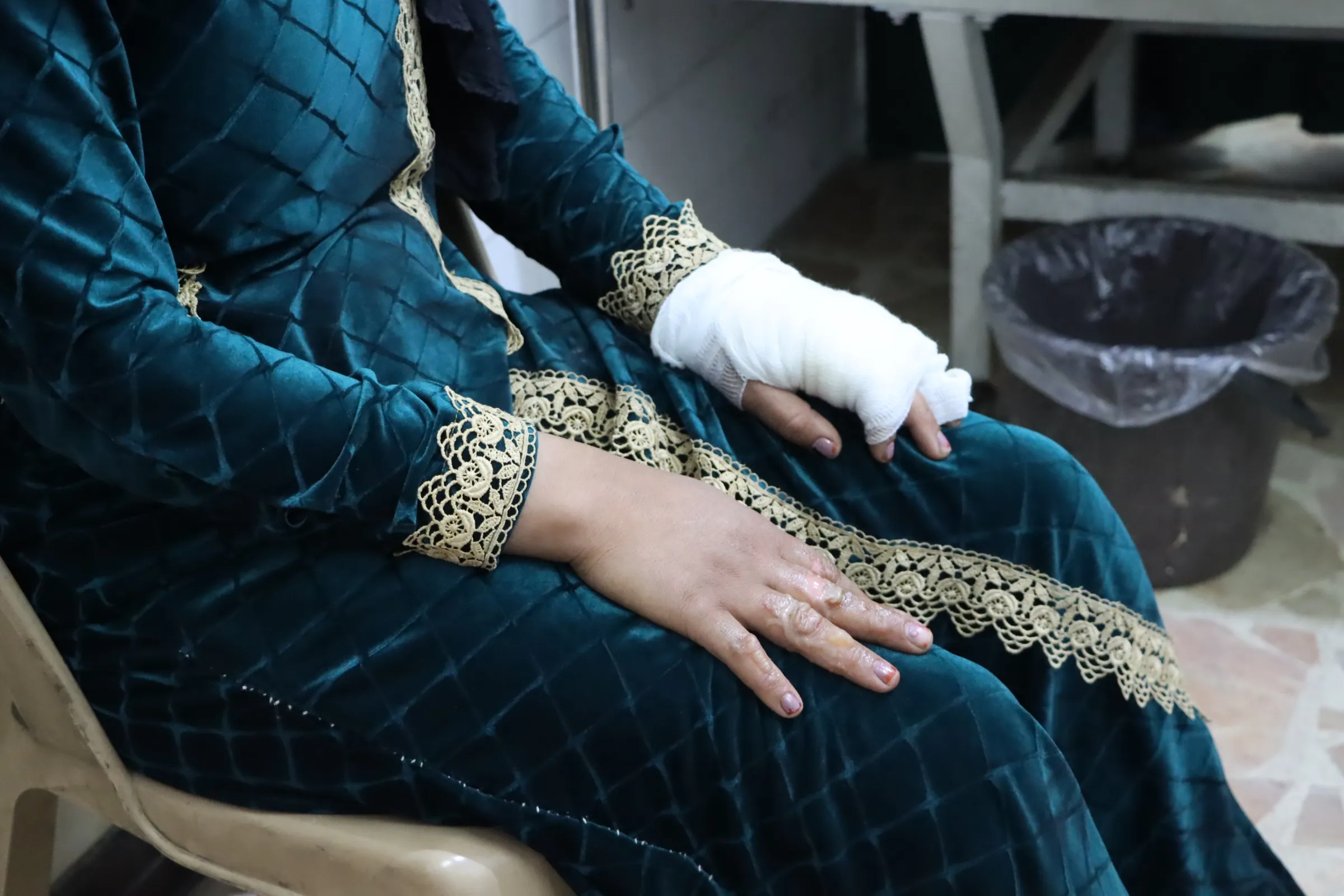 إصابة 3 عاملات جراء حريق معمل للتنر في قامشلو – تم التحديث