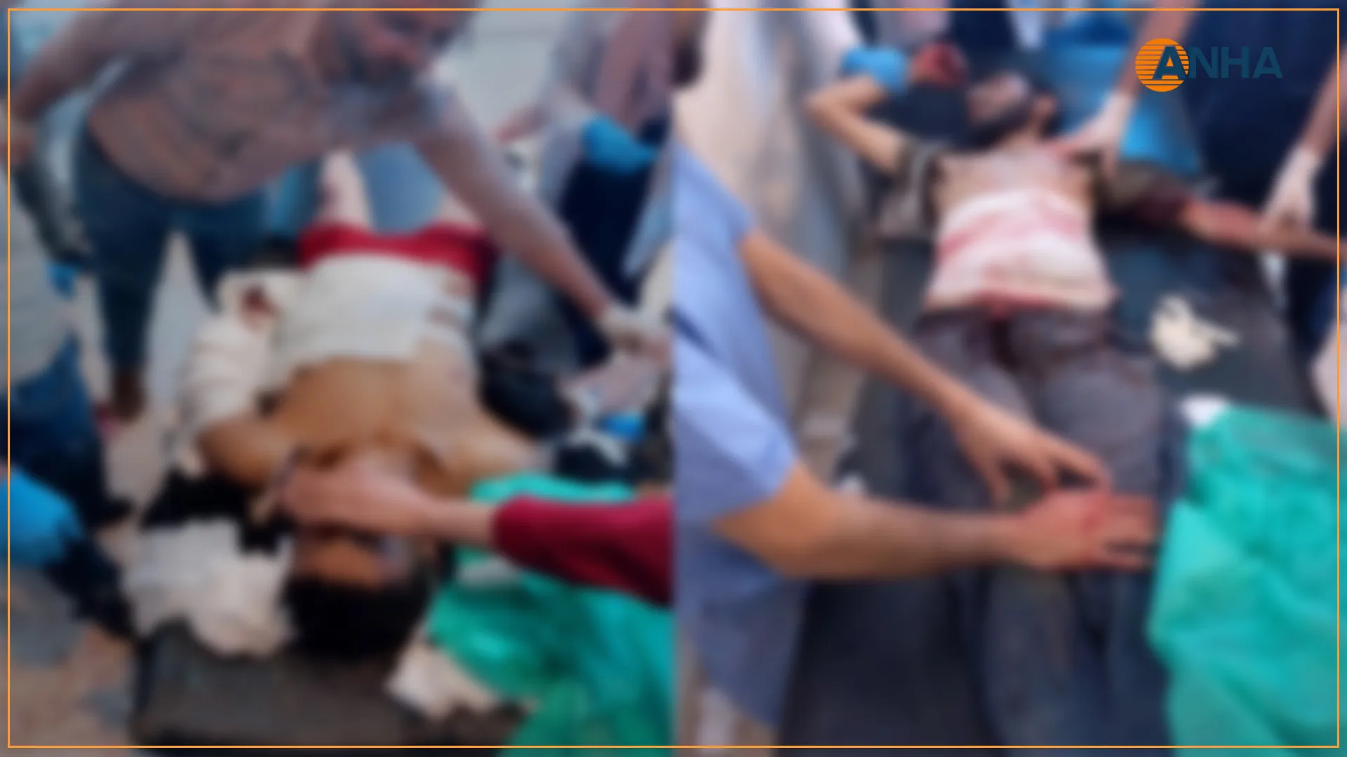 ​​​​​​​إصابة 3 مواطنين بينهم طفل في قصف للاحتلال التركي على عين عيسى - تم التحديث  
