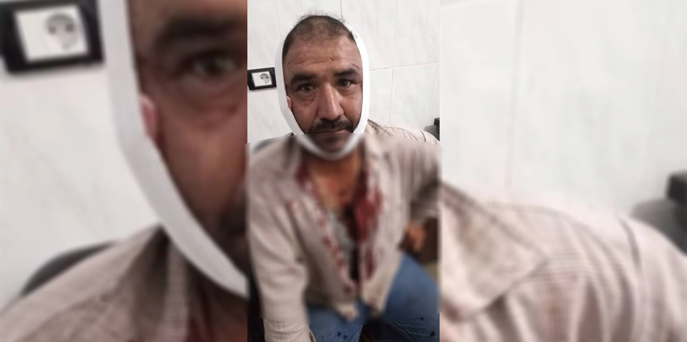 ​​​​​​​قصف تركي على ناحية تل رفعت في الشهباء وإصابة مواطن