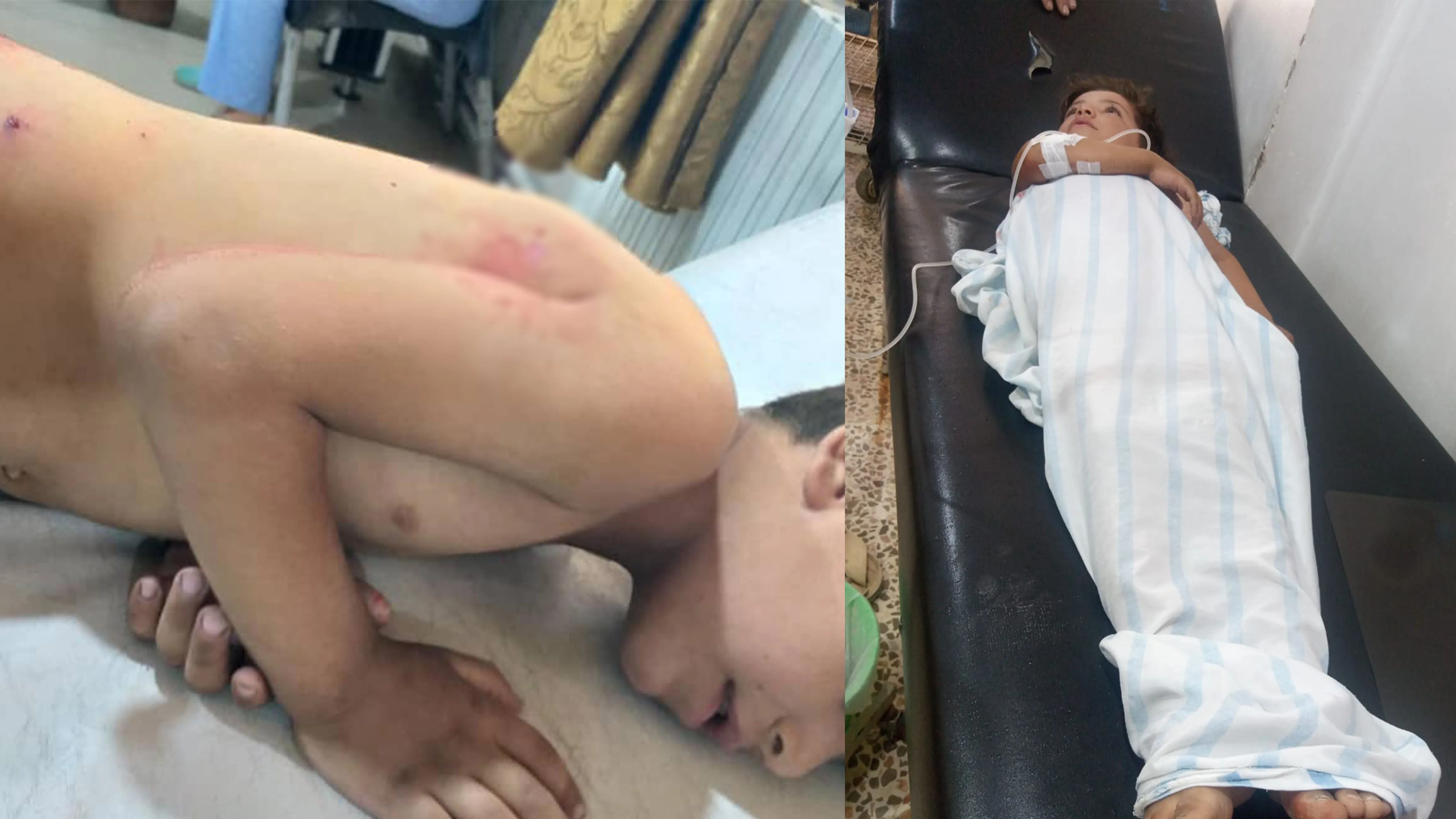 إصابة أمّ و3 من أطفالها بقذائف حكومة دمشق ومرتزقة الدفاع الوطني في الحسكة
