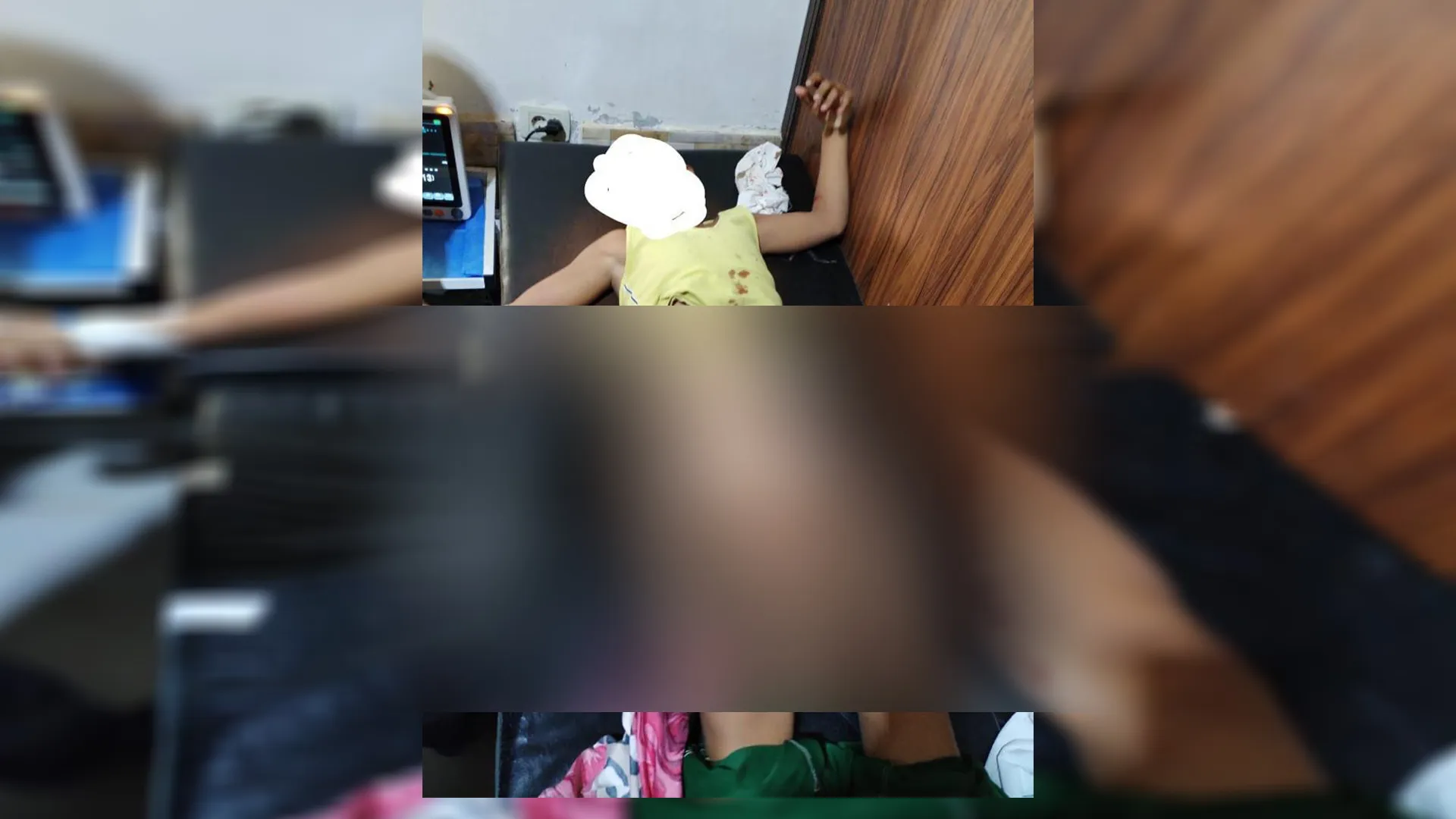 ​​​​​​​إصابة طفل جراء انفجار لغم من مخلفات داعش