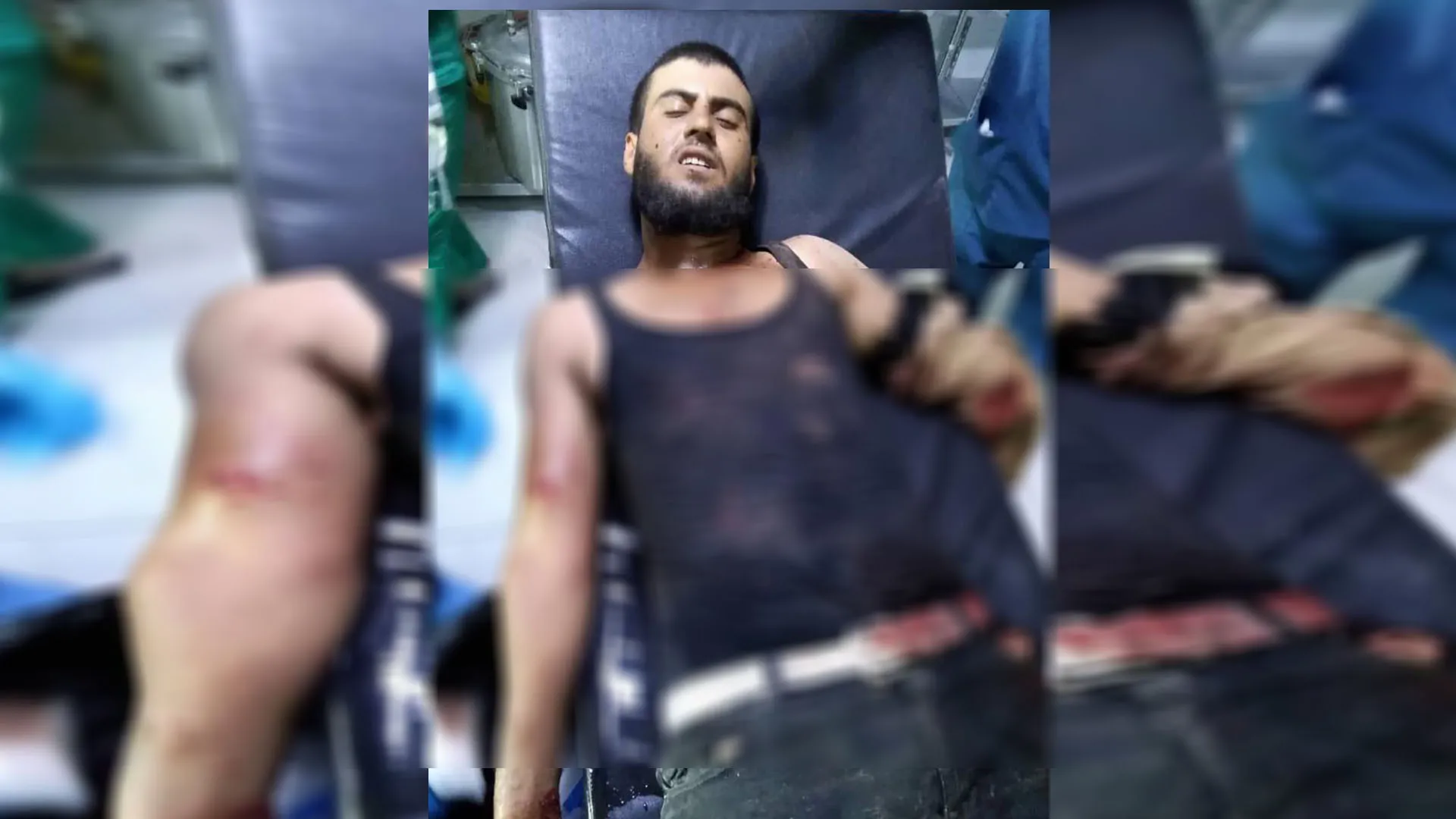 ​​​​​​​إصابة مواطن في قصف للاحتلال التركي على عين عيسى