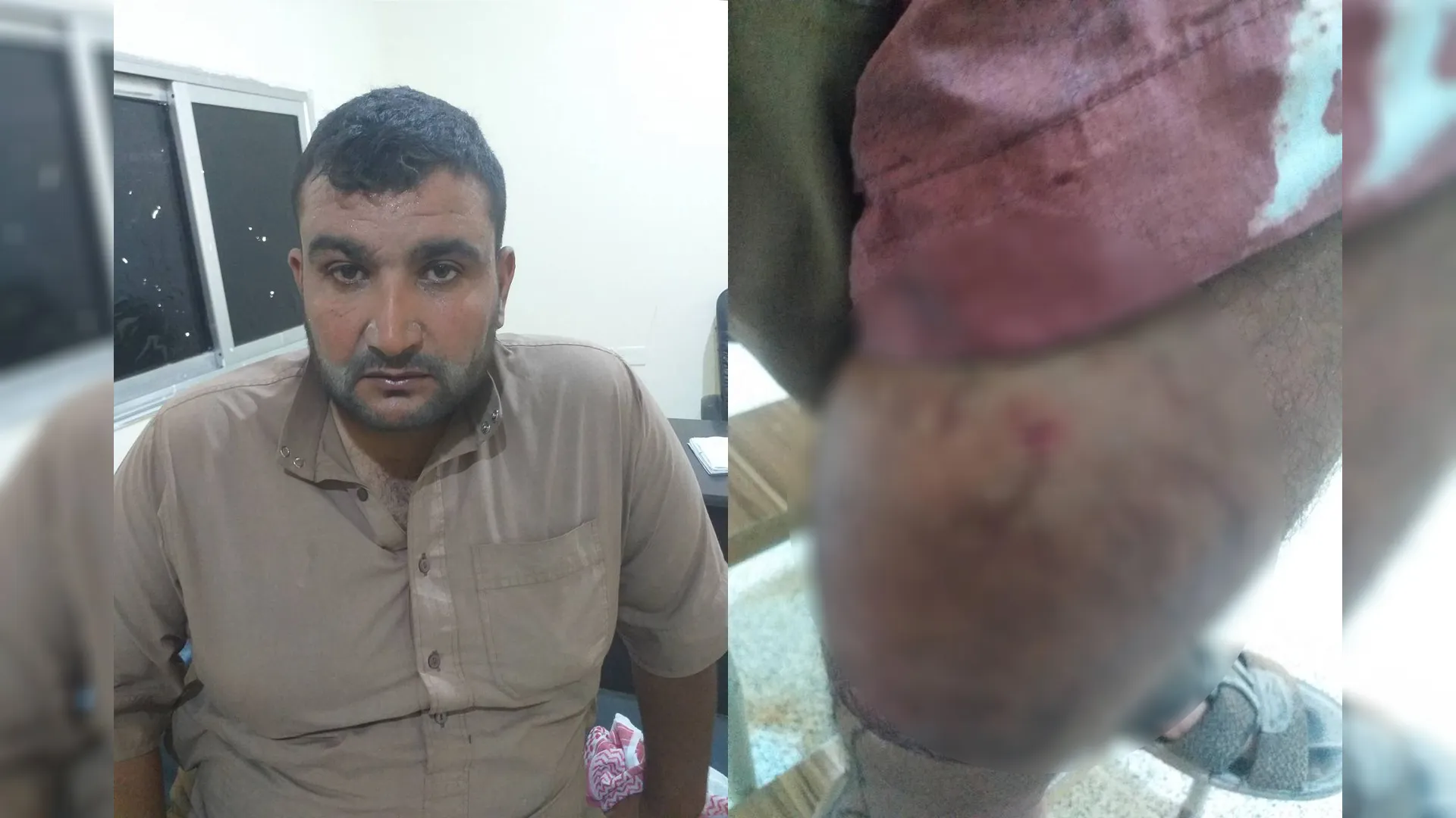 ​​​​​​​إصابة مواطن في قصف مسيّرة للاحتلال التركي على عين عيسى