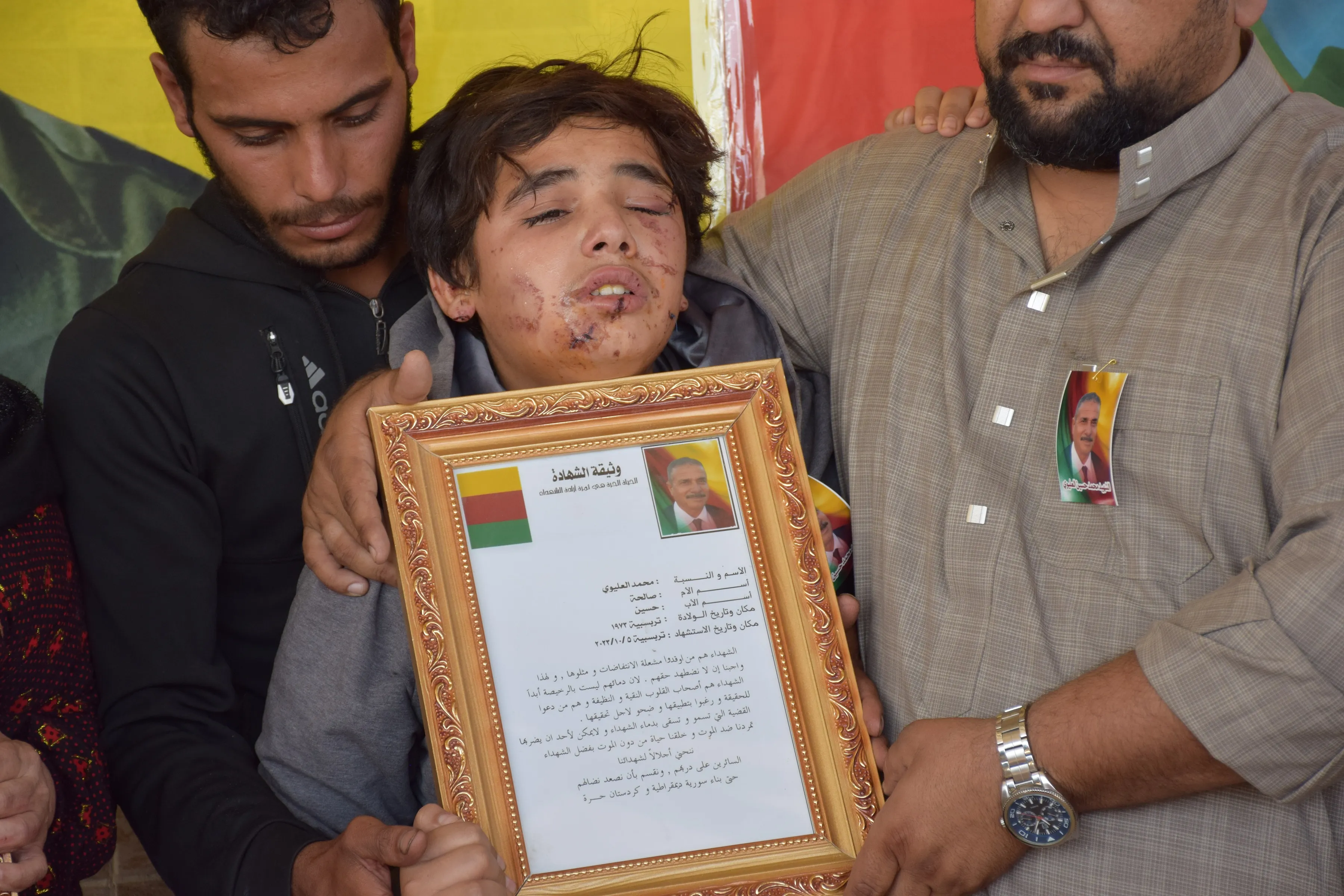 جثمان المواطن محمد العليوي يوارى الثرى في تربه سبيه