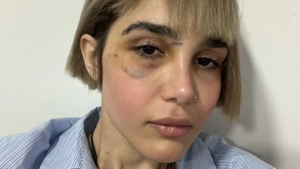 في إيران والسليمانية صحفية كردية تعاني من الذهنية الذكورية