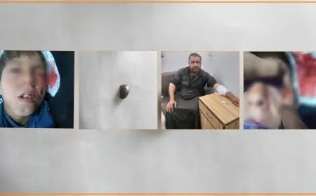 إصابة شخصين أحدهما طفل في استهداف تركي لريف منبج