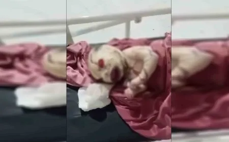 حالة نادرة جداً.. ولادة "طفل الشمع" في كوباني