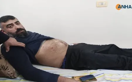 إصابة عامل في محطة الكهرباء نتيجة القصف التركي