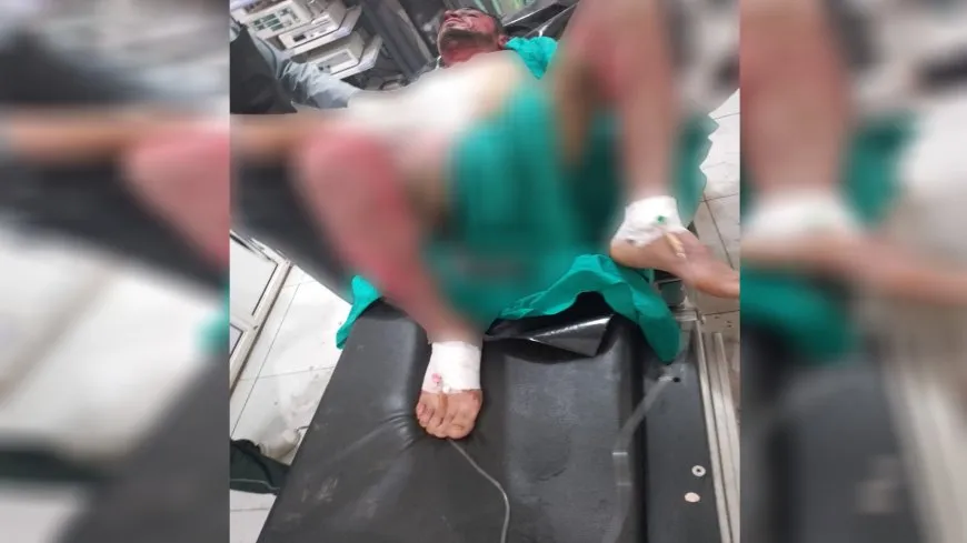 وفاة عامل وإصابة 5 باحتراق فرن في منبج