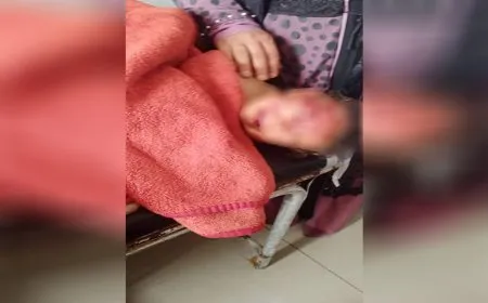 فقدان طفل وإصابة آخرين في انفجار جسم من مخلفات داعش بدير الزور