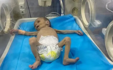 رئيس بعثة المجلس الدولي لحقوق الإنسان: بنود التصنيف العالمي للمجاعة مثبتة في غزة