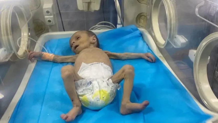 رئيس بعثة المجلس الدولي لحقوق الإنسان: بنود التصنيف العالمي للمجاعة مثبتة في غزة