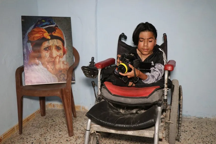 عدم الاستسلام وقوة التحدي عنوان قصة الشاب بانكين 