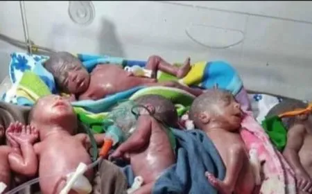 امرأة تنجب 6 توائم في منبج