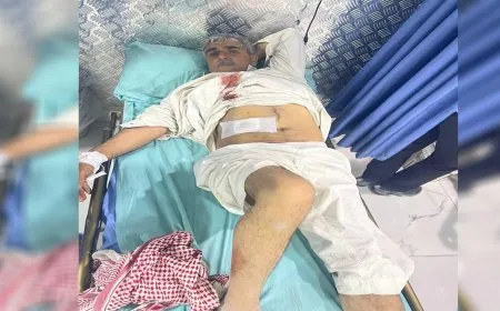 أسماء 9 من المصابين في القصف التركي لريف تل حميس 