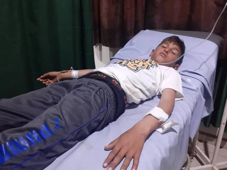 Child injured due to Turkish occupation shelling on rural Manbij