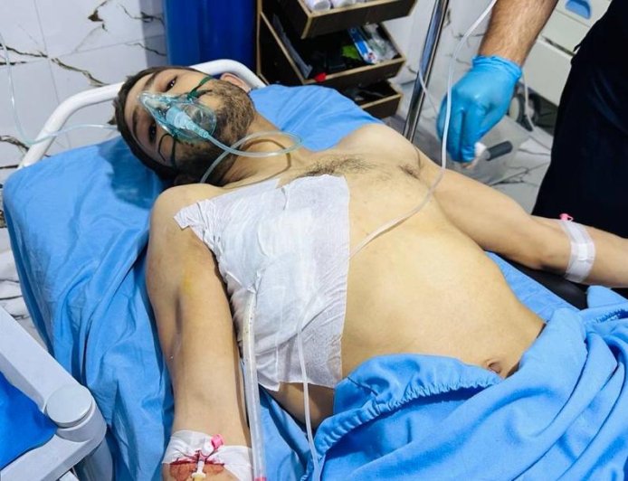 إصابة مواطن في ريف كوباني في استهداف بمسيرة انتحارية