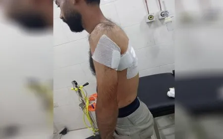 إصابة مواطن جراء انفجار قرب مطار قامشلو