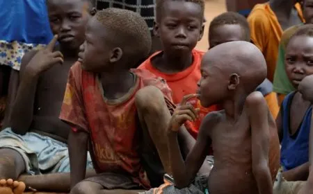 بسبب سوء التغذية فقدان 3 أطفال لحياتهم في السودان
