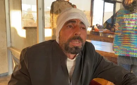 مصابون يروون لحظات الاستهداف ويؤكدون بقاءهم على السد لحمايته