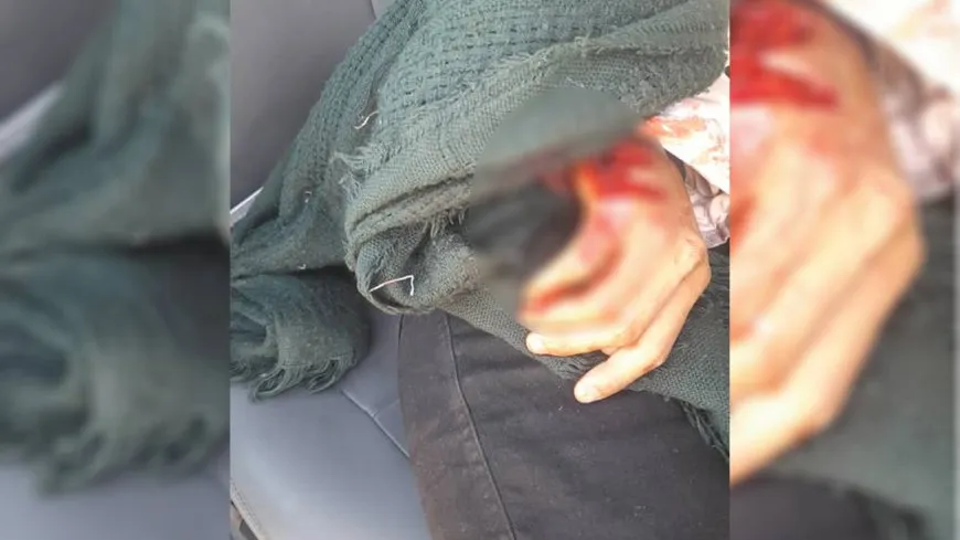 مشاهد استهداف الاحتلال التركي ومرتزقته قافلة مدنيين في محيط سد تشرين