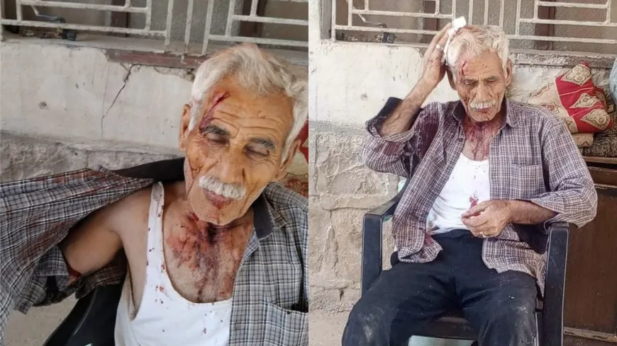 مرتزقة الاحتلال التركي يعتدون بوحشية على مسن كردي في عفرين ويسرقون ممتلكاته