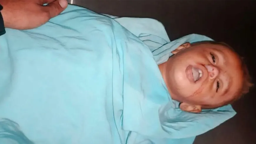 طفل يفقد حياته بلدغة أفعى في مخيم "واشو كاني" بالحسكة