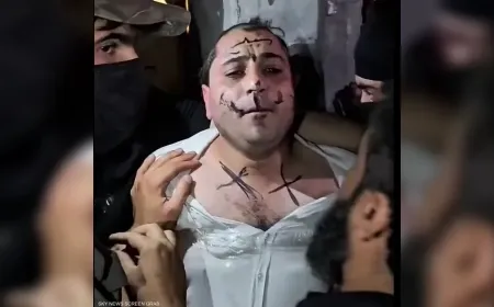 استمرار الاعتداءات على الفنانين في مناطق سيطرة الحكومة الانتقالية 