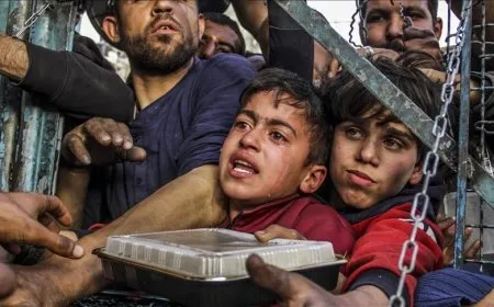 اليونيسف: أكثر من 10 آلاف طفل في غزة بحاجة للعلاج من سوء التغذية الحاد