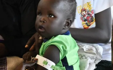 اليونيسف: مليونا طفل مهددون بسوء التغذية في السودان