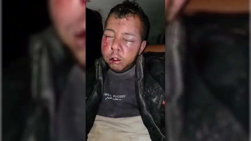 إصابة 5 سوريين برصاص "الجندرما" في ريف سري كانيه المحتلة