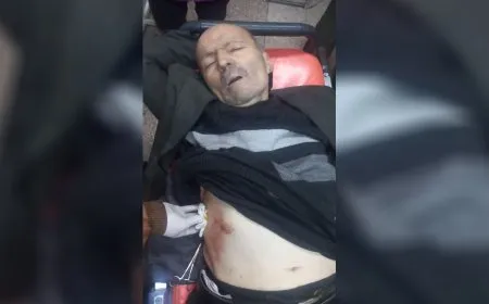 إصابة مدني آخر جراء قصف مرتزقة الحكومة المؤقتة على حي الشيخ مقصود في حلب