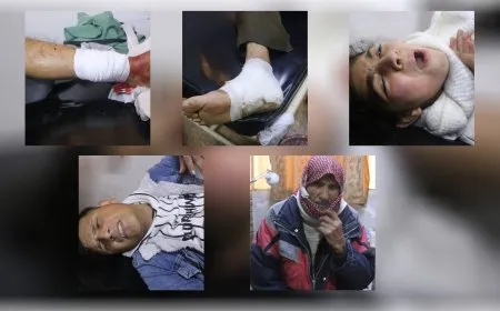 ارتفاع عدد ضحايا قصف مرتزقة الحكومة المؤقتة على أحياء محاصرة في حلب إلى 72 