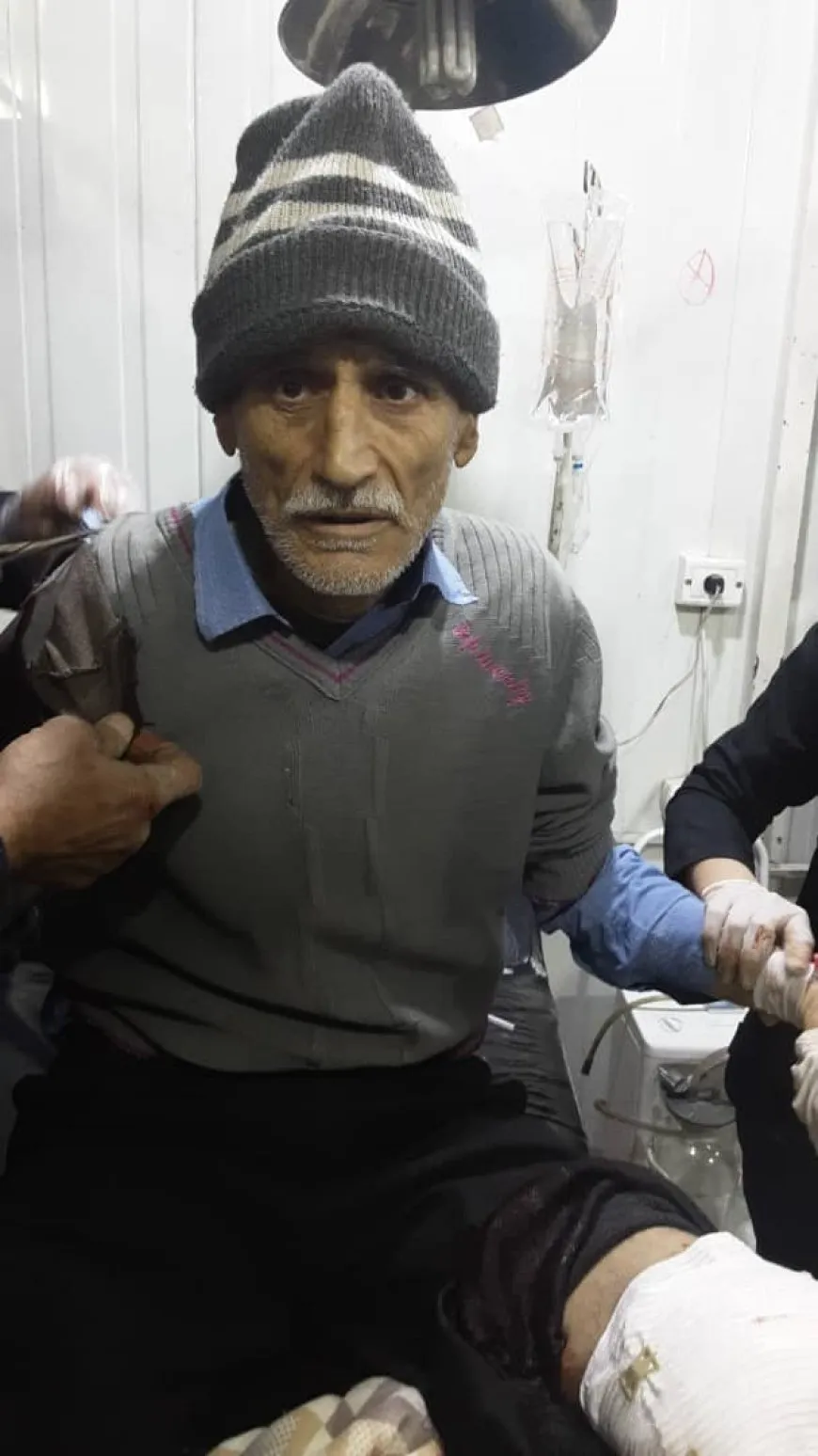 3 شهداء و17 جريحاً في آخر حصيلة لقصف الحكومة المؤقتة على أحياء حلب